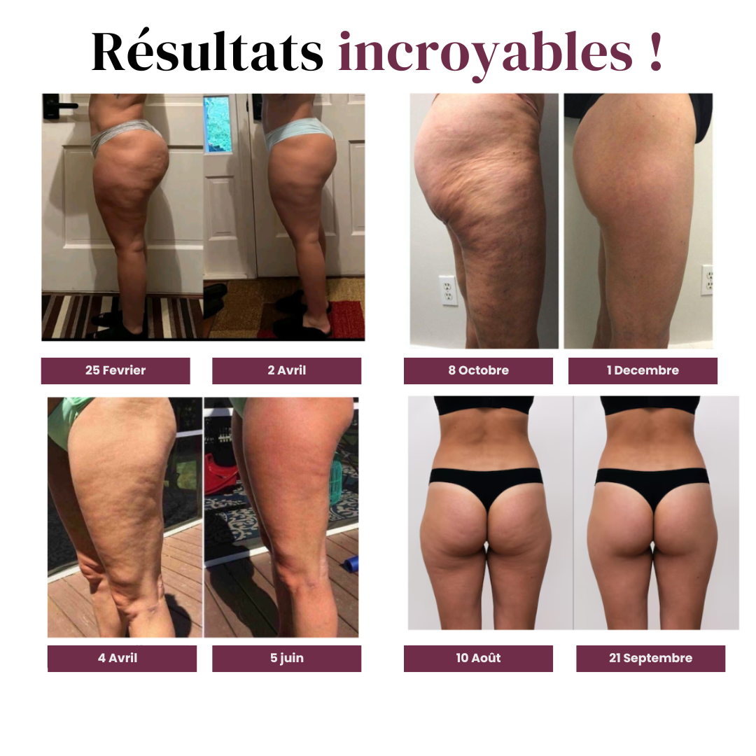 Legging 3D Anti-Cellulite